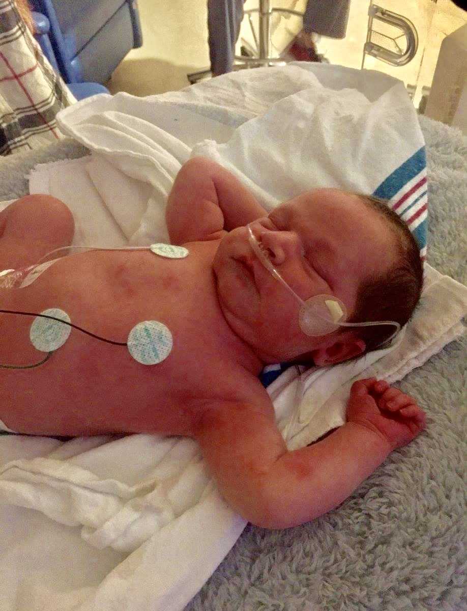 newborn baby lying on a blanket at the hospital with wires attached to him 