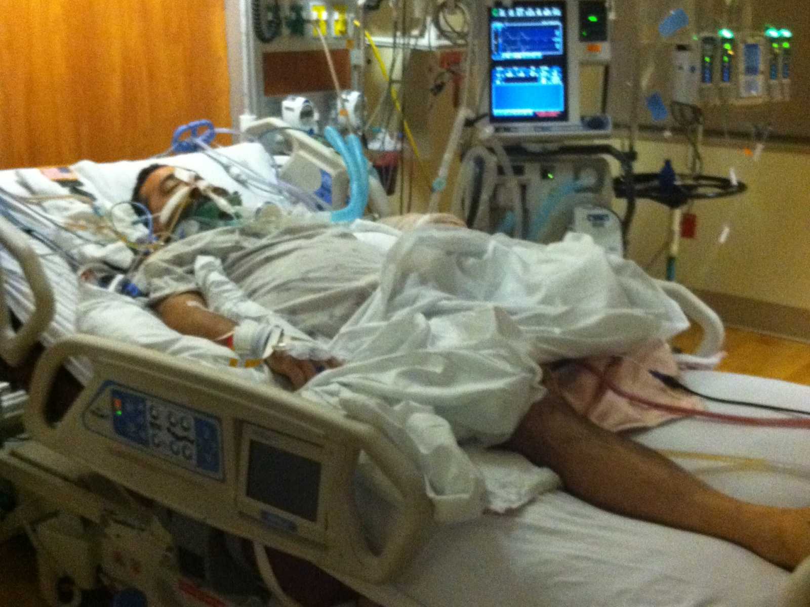 soldier in hospital bed with countless machines hooked up to him and he's missing a leg