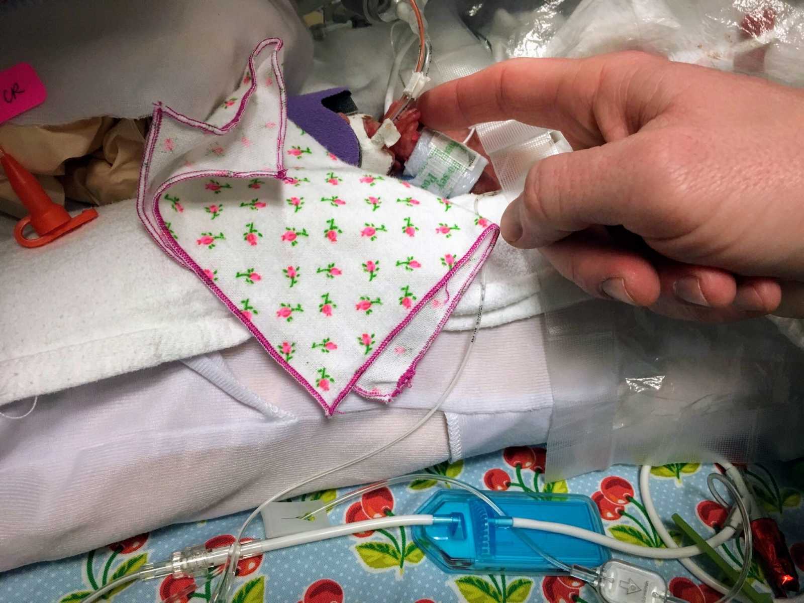 Hand touches 1 pound preemie baby hand in NICU