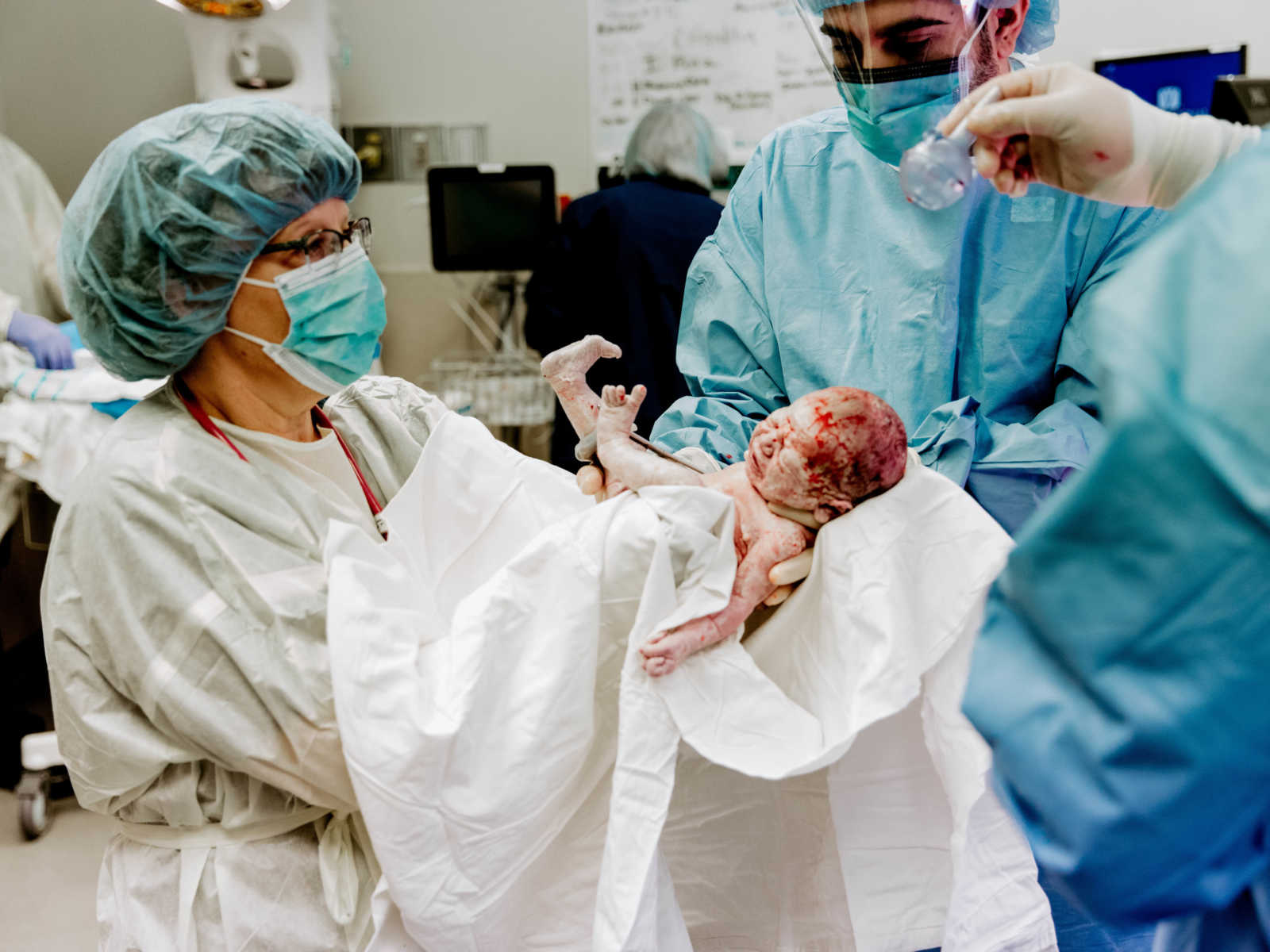 Nurse holds up newborn c-section baby with bloody head in white cloth 