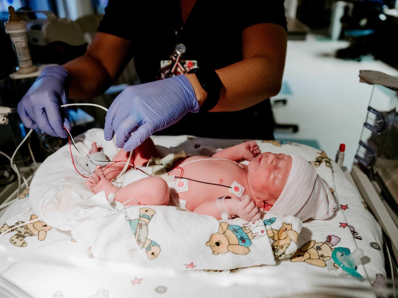 Newborn who was birthed via c-section lays on hospital bed while nurse attaches wires to its body