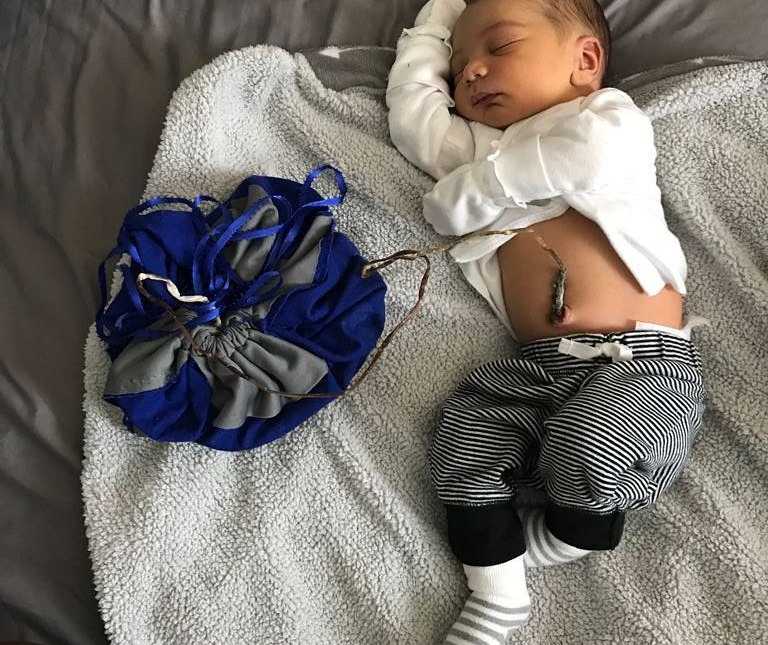 newborn sleeping on back with belly showing that has placenta still attached