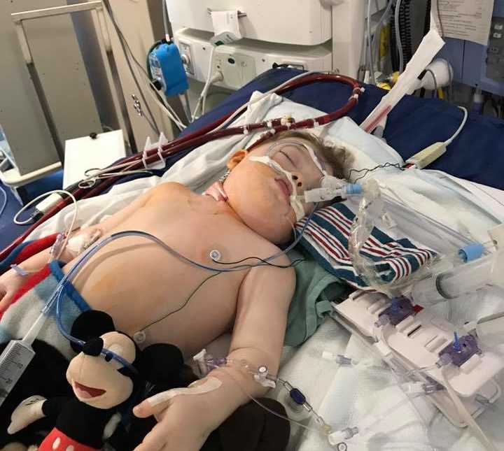 toddler boy laying shirtless holding stuffed mickey mouse on hospital bed with wires attached to chest and head 