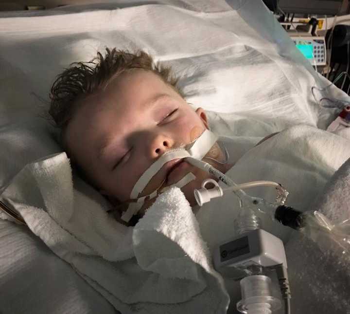 toddler boy asleep in hospital bed with machine attached to his mouth with hair spiked up