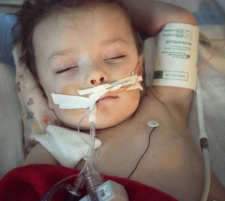 toddler boy sleeping with arm behind his head with orange and clear wire up his nose held by white tape