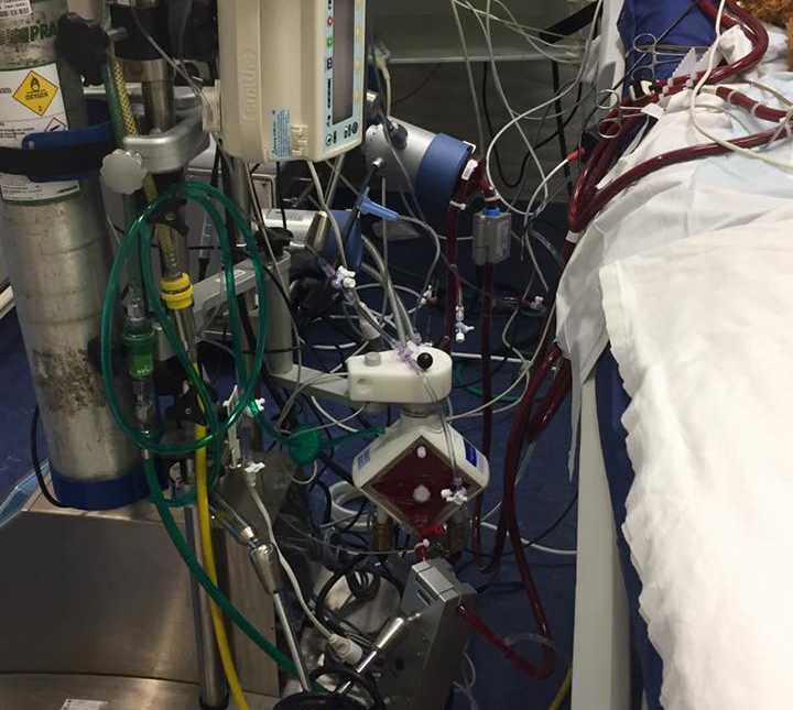 Hospital machine that was hooked up to young boy after severe complications with flu like symptoms