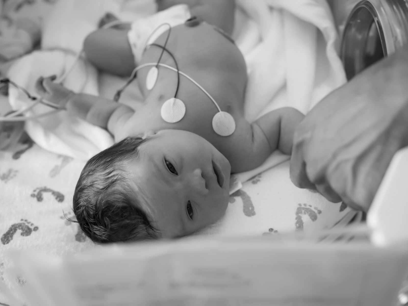 down syndrome newborn girls lies awake in hospital bed holding hands with mother