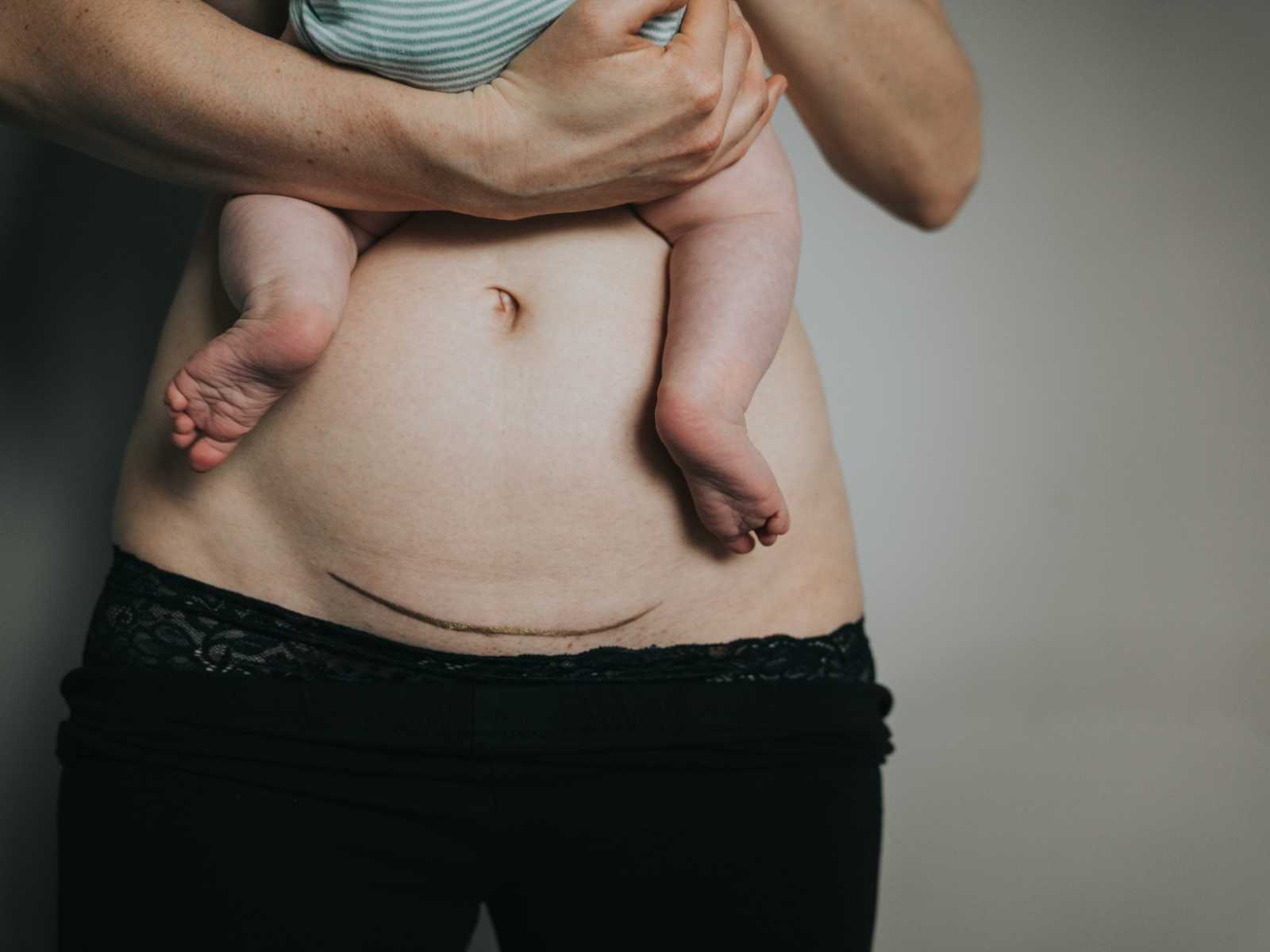 Close up of woman's stomach with stretch mark covered in gold dust while holding baby
