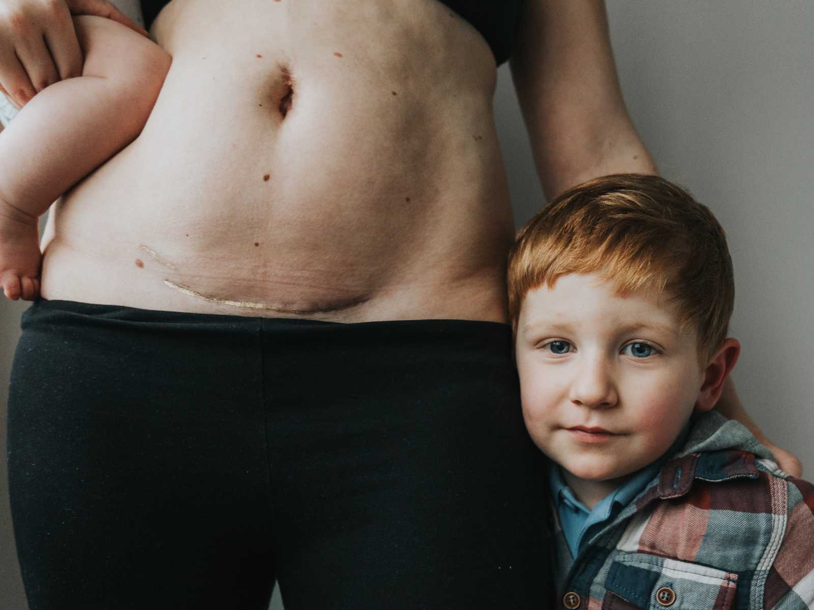 Close up of woman's c-section scar covered in gold dust with arm around red-haired son while holding other baby in other arm
