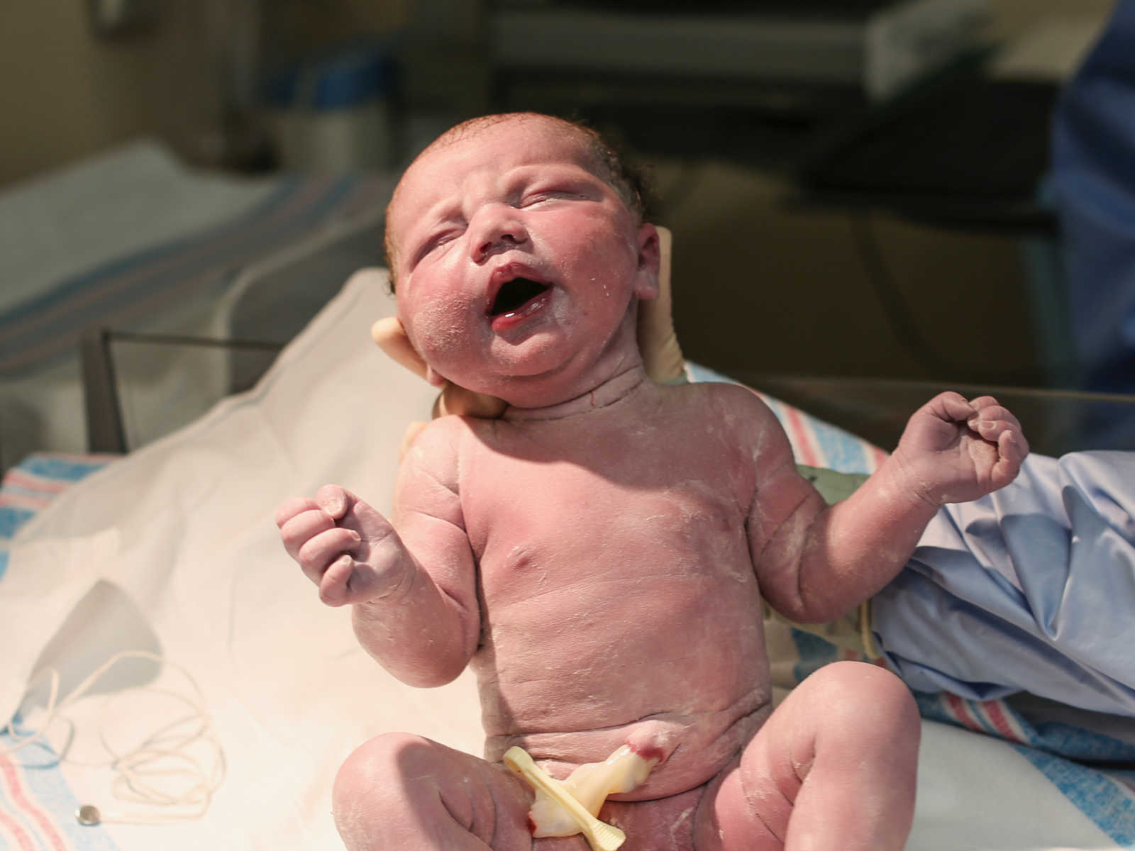 Nurse holding up newborn whose head was still stuck in amniotic sac