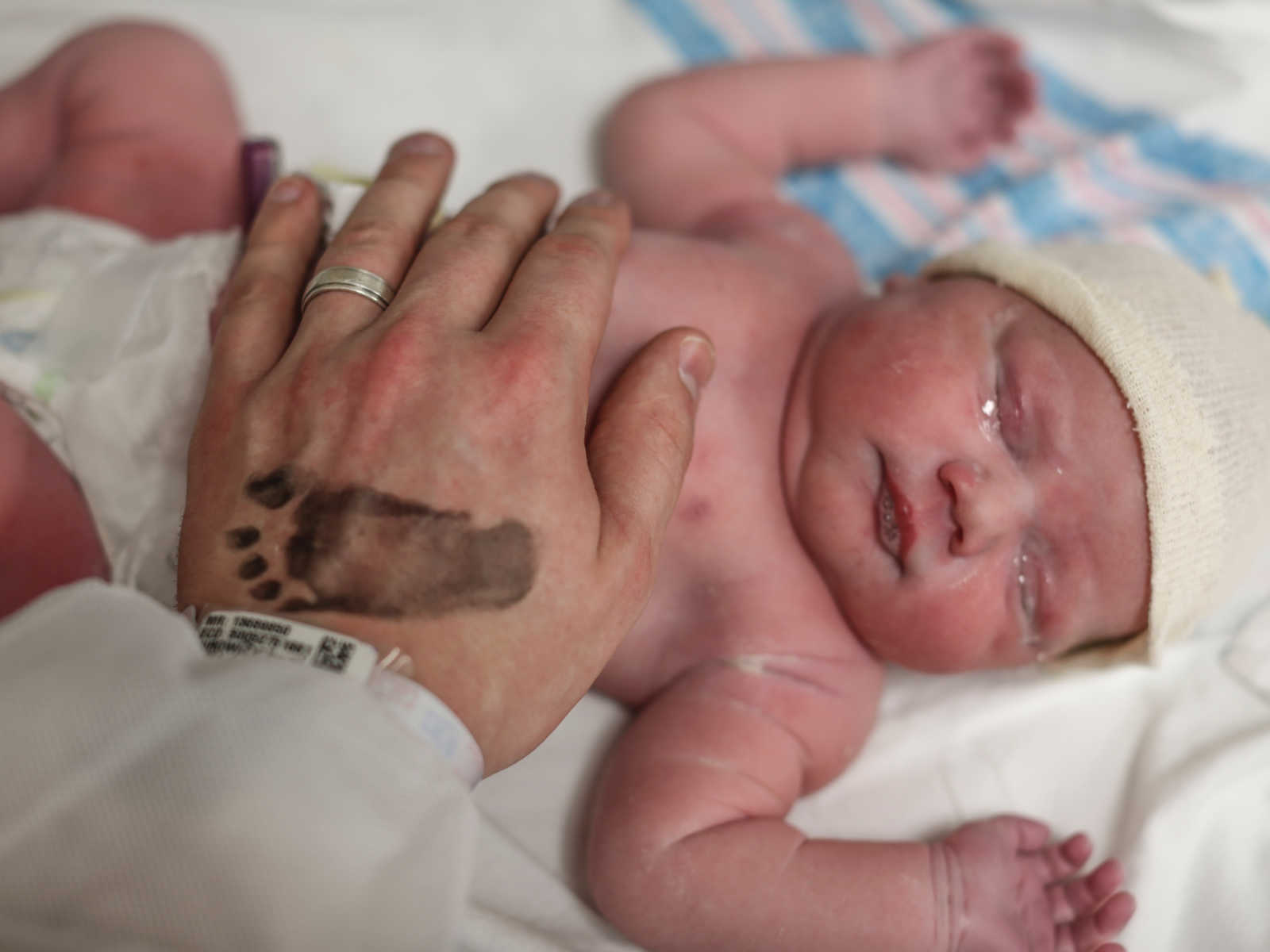 Newborn whose head was stuck in amniotic sac lies on back and adult hand with baby footprint on it touches it’s chest