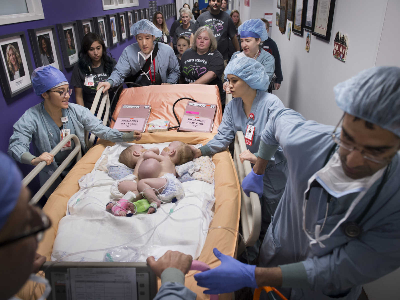 six doctors pushing conjoined twins in hospital bed down a hallway with mother and others following in matching tshirts