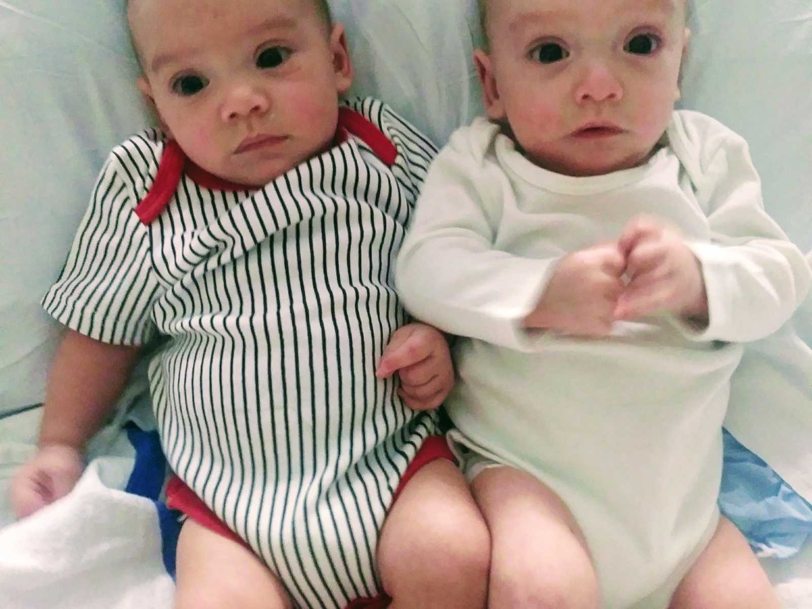 Twin boys who need bone marrow transplant lie on back in onesie