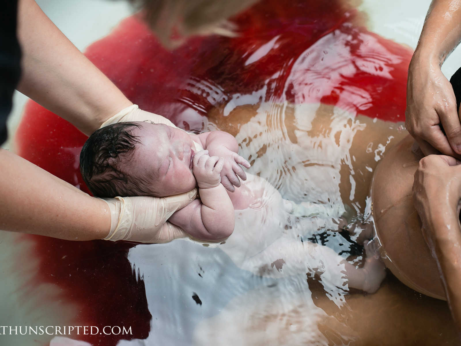 woman giving birth in bloody water while someone pulls out baby