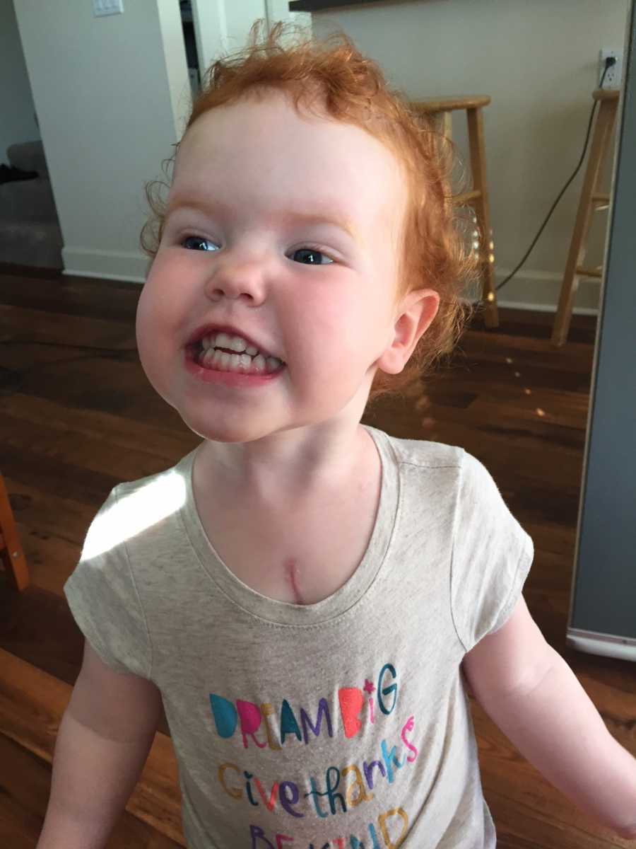 Toddler smiles as open heart surgery scars pops out of top of shirt