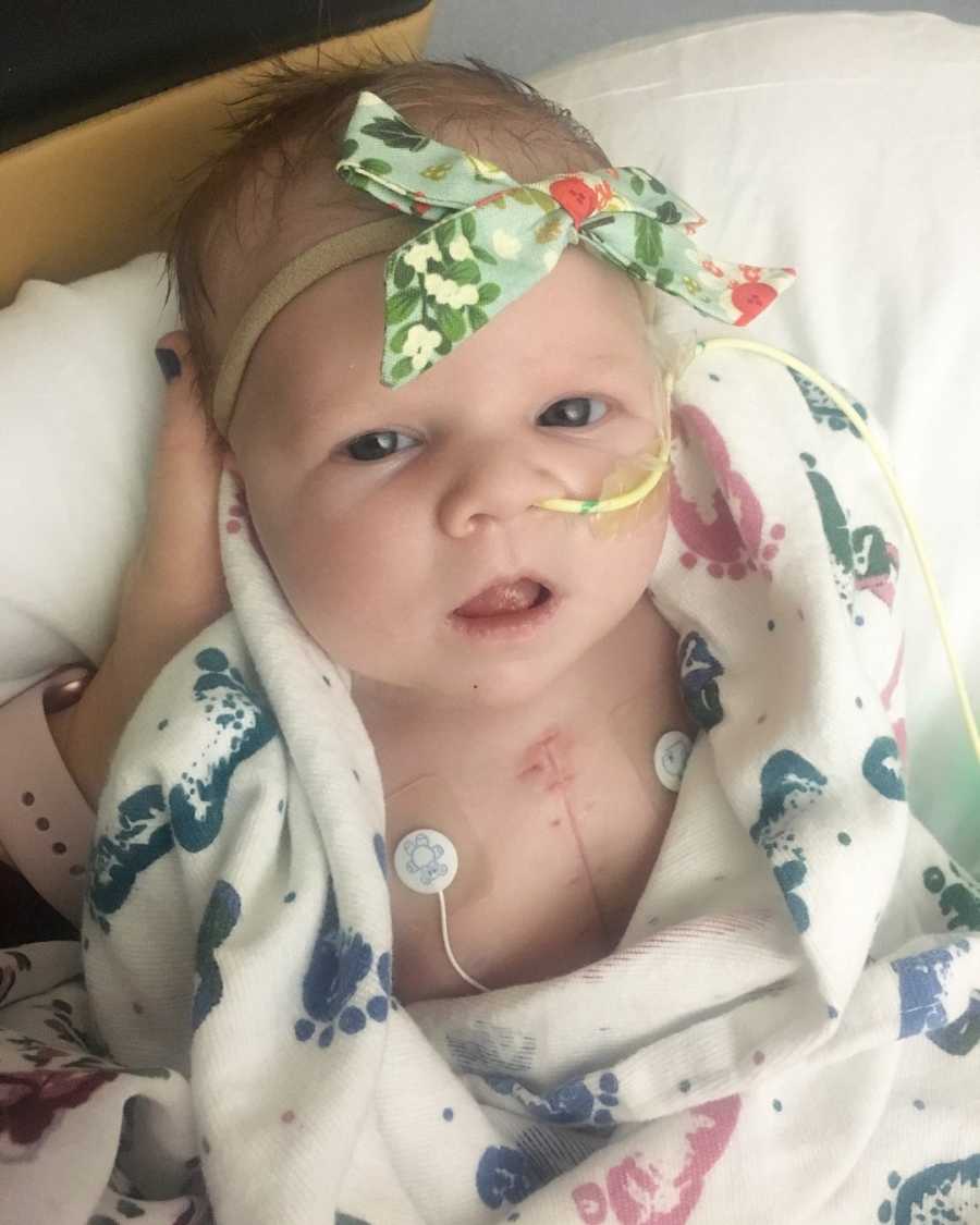 Newborn with chord up her nose looks up after open heart surgery