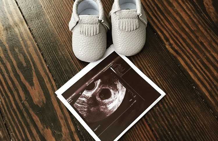 White leather baby moccasins placed next to ultrasound 