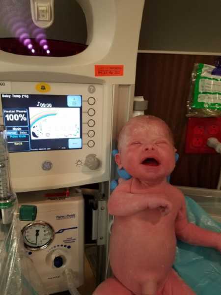 Naked newborn with down syndrome sitting next to hospital machine
