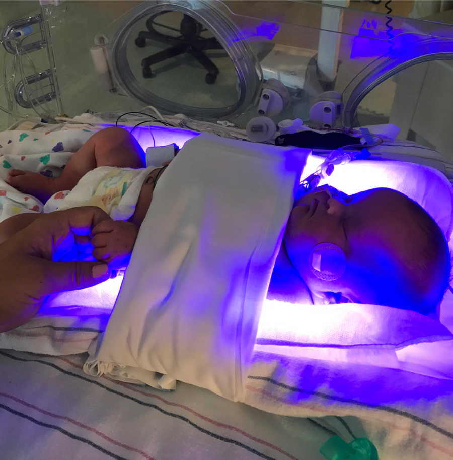 Baby girl with HIHA lying in hospital bed hooked up to an IV nutrition machine