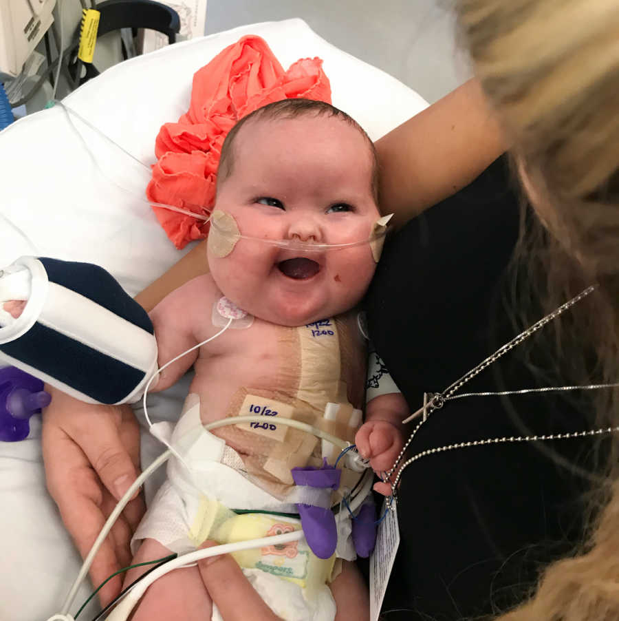 Newborn with heart defect in NICU looking up at mother 