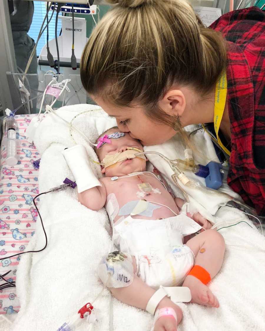 Mother kisses forehead of newborn that will soon pass away
