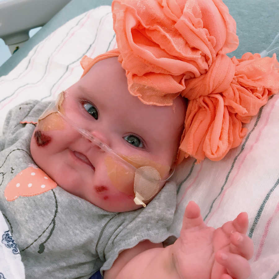 Close up of baby who had open heart surgery and seizure lying in hospital bed with oxygen up her nose