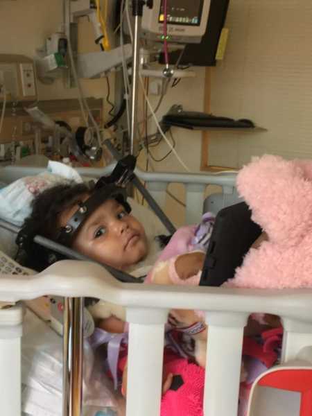 Toddler who was internally decapitated wears halo in hospital bed and looks to the side