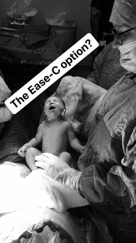 Doctor holding newborn who was born through c section with caption over it saying, "The ease-c option?"