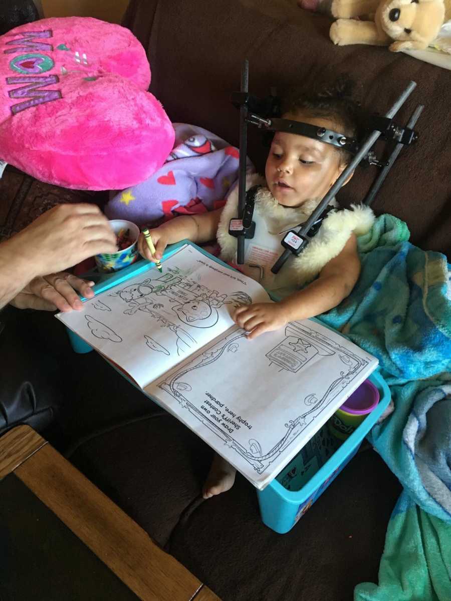 Toddler who was internally decapitated wears halo brace while sitting on the couch coloring