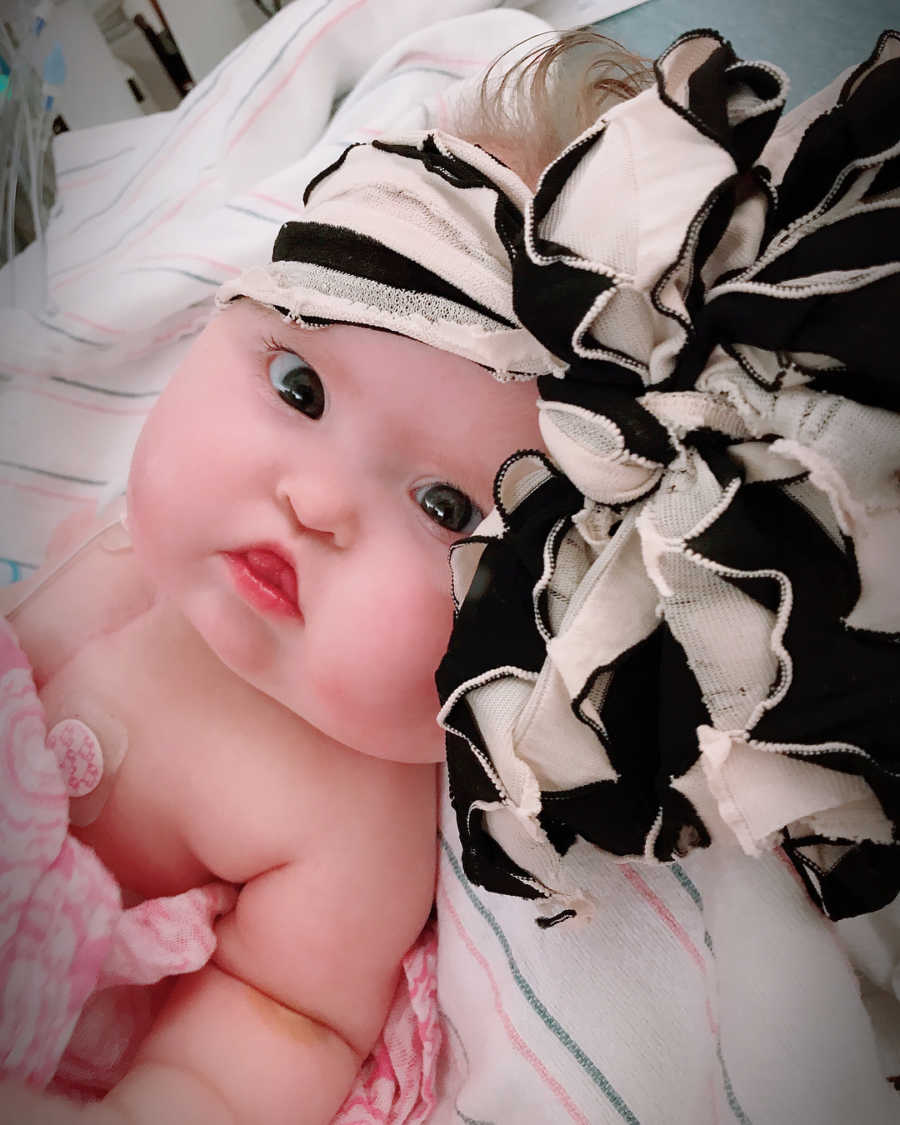 Close up of baby with heart defect lying in hospital bed with large black and white bow on her head