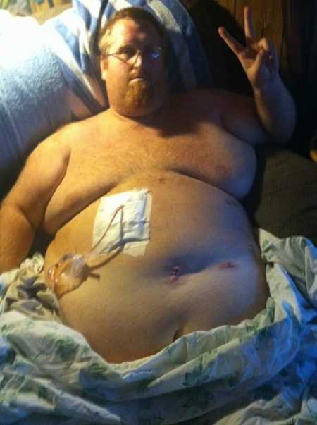 500 pound man lays shirtless in hospital bed holding up a peace sign before gastric bypass surgery