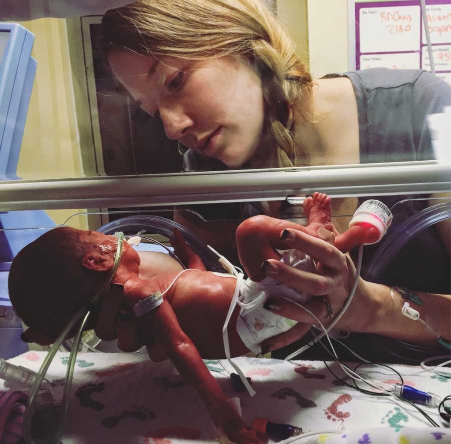 Mother who had fertility issues holds one of her underweight newborns in NICU