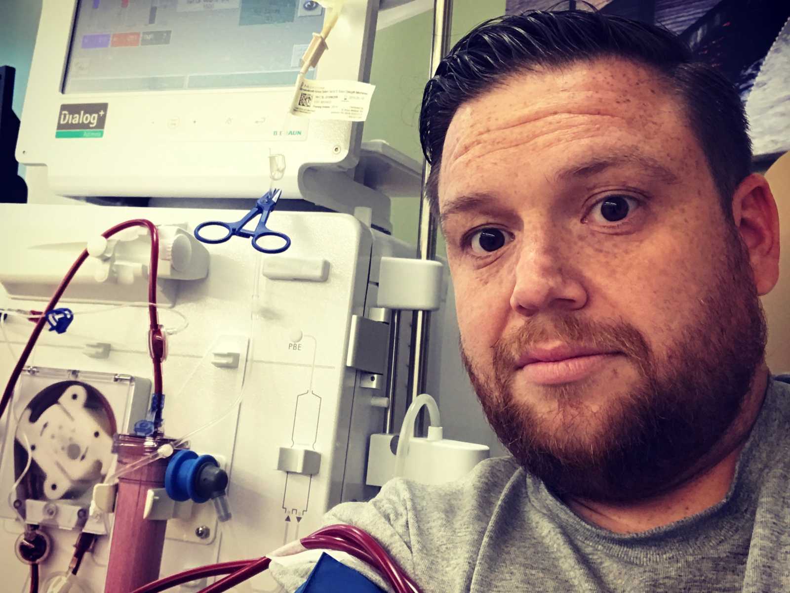 Man who needs kidney transplant takes selfie with hospital machine