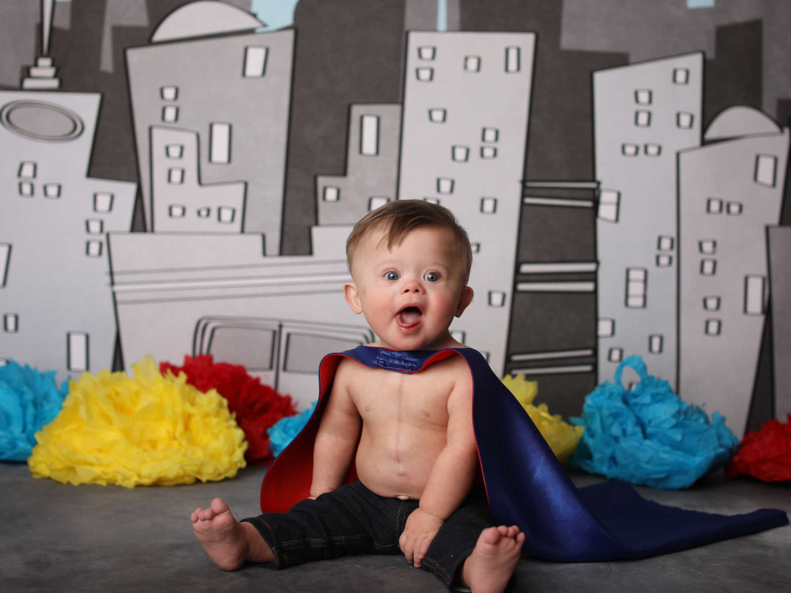 Baby with down syndrome sitting on floor with cape on with fake city skyline in background