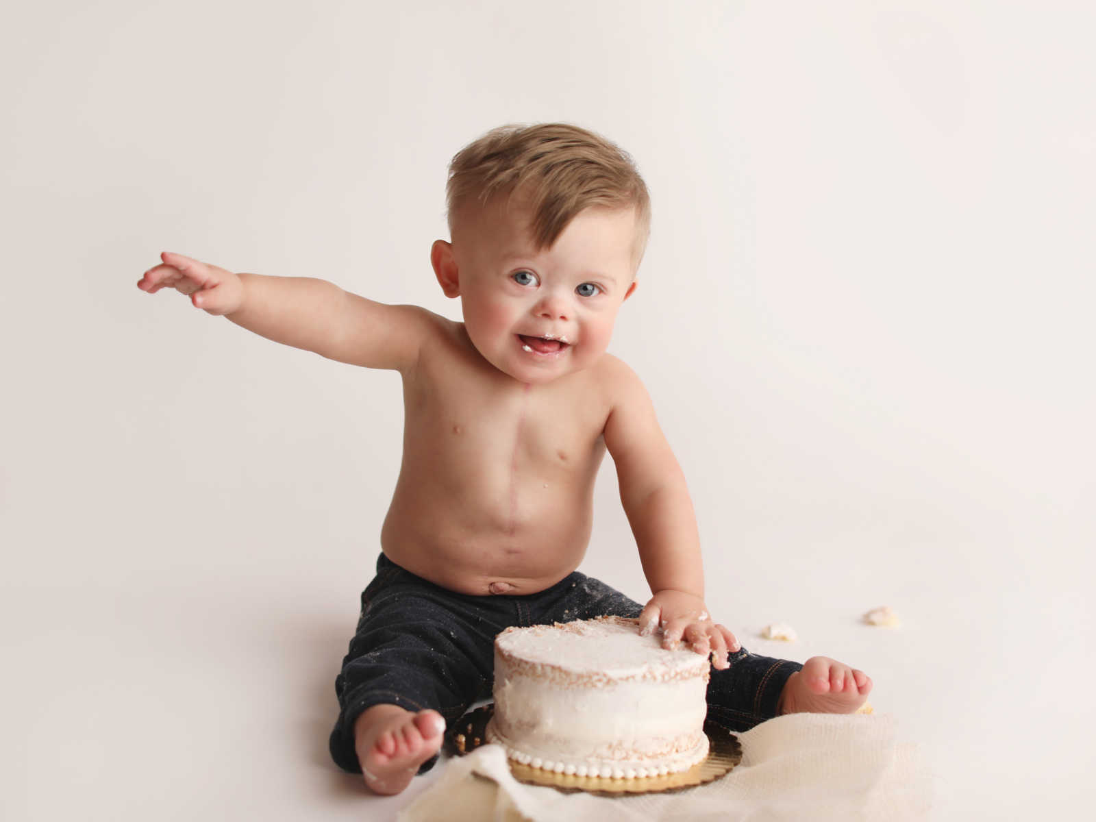 Shirtless down syndrome baby eating cake with his hands