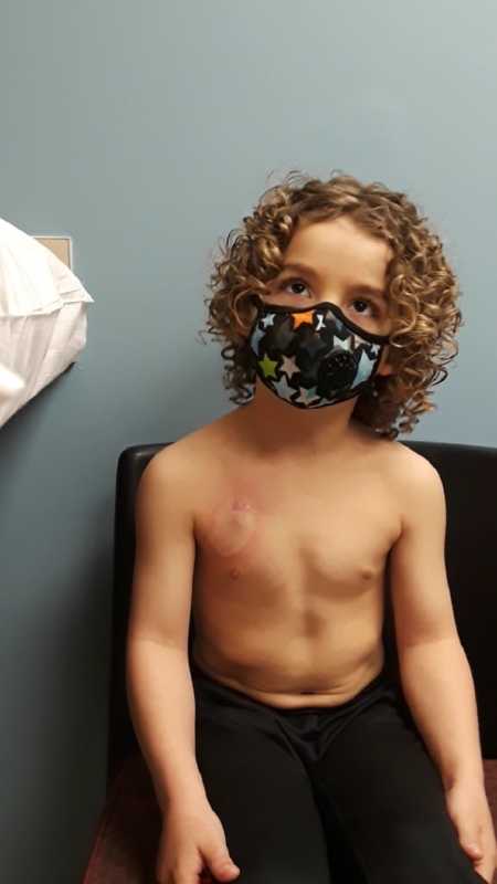 Boy with leukemia sits on doctors office with mask on a shirt off that reveals a scar on his chest