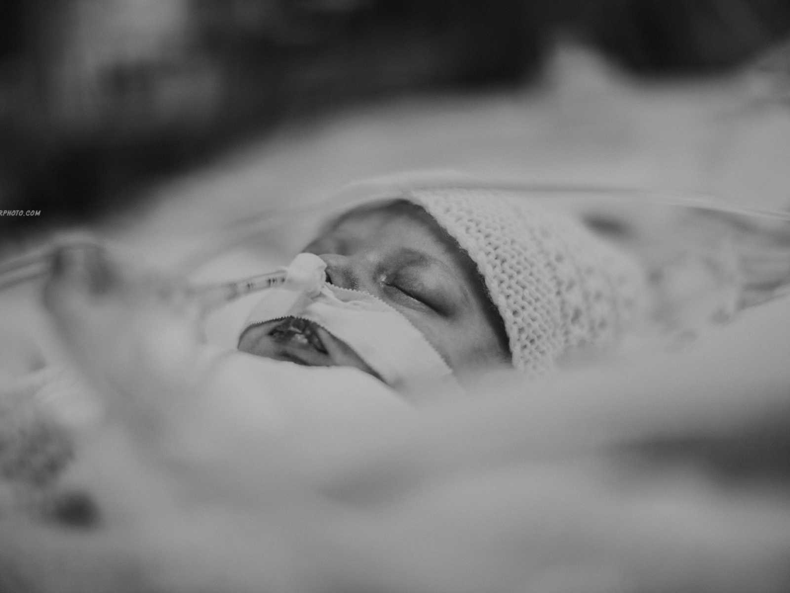 Close up of newborn breathing with a tube up his nose taped down above his lip