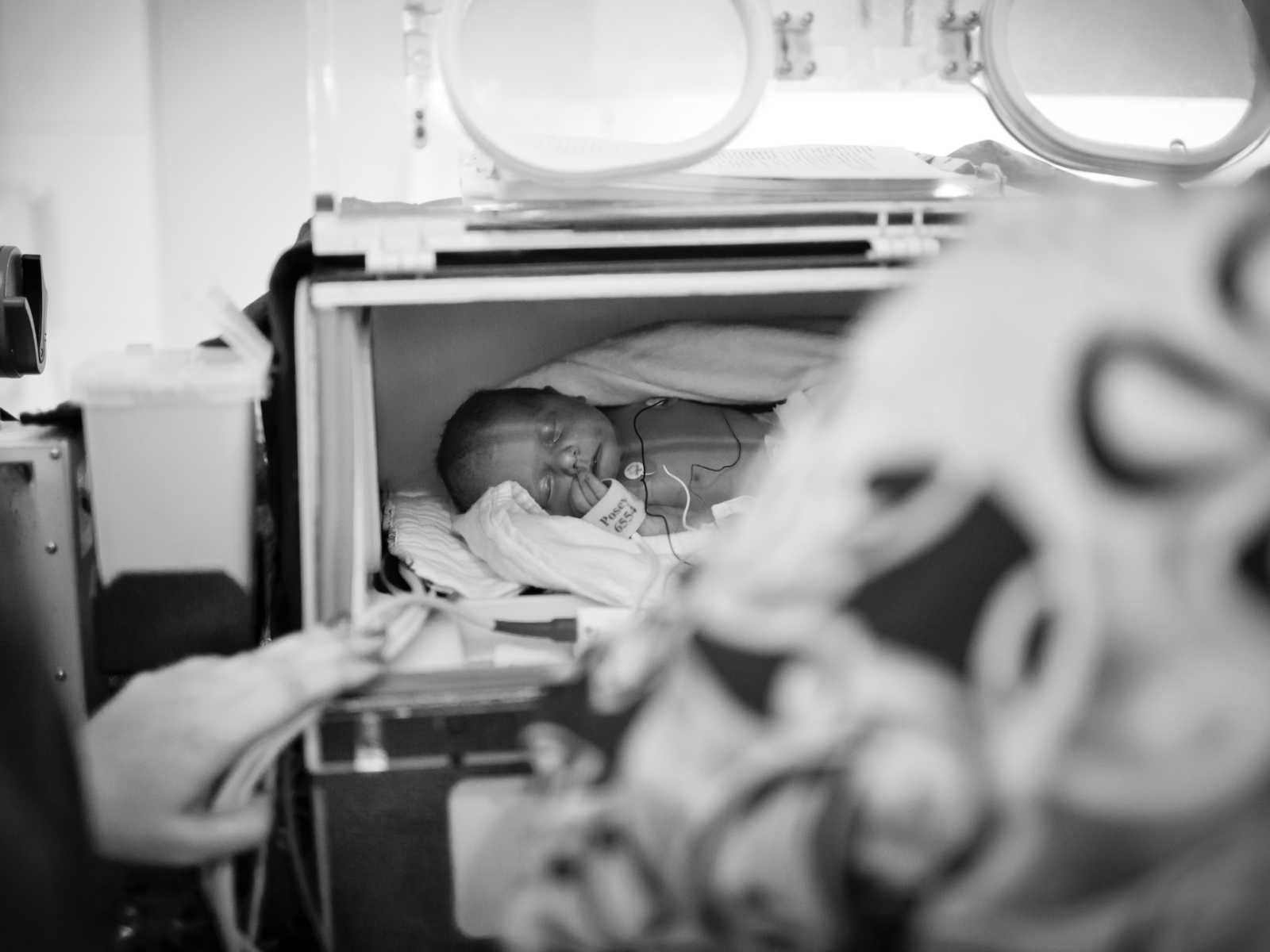 Newborn baby sleeping in hospital machine with wires attached to his chest