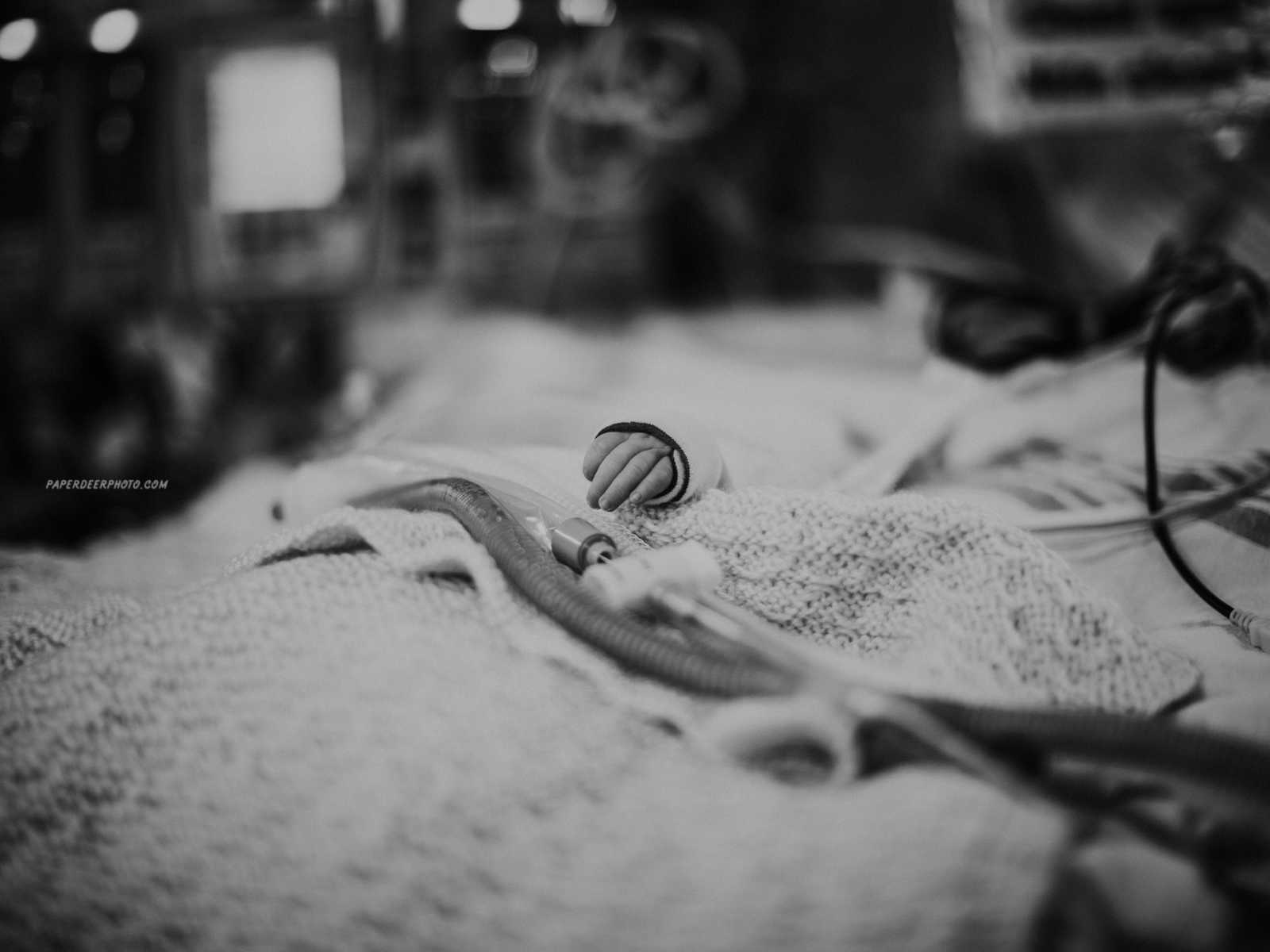 Wires going across blanket that newborn is sleeping in with newborn's hand peeking out