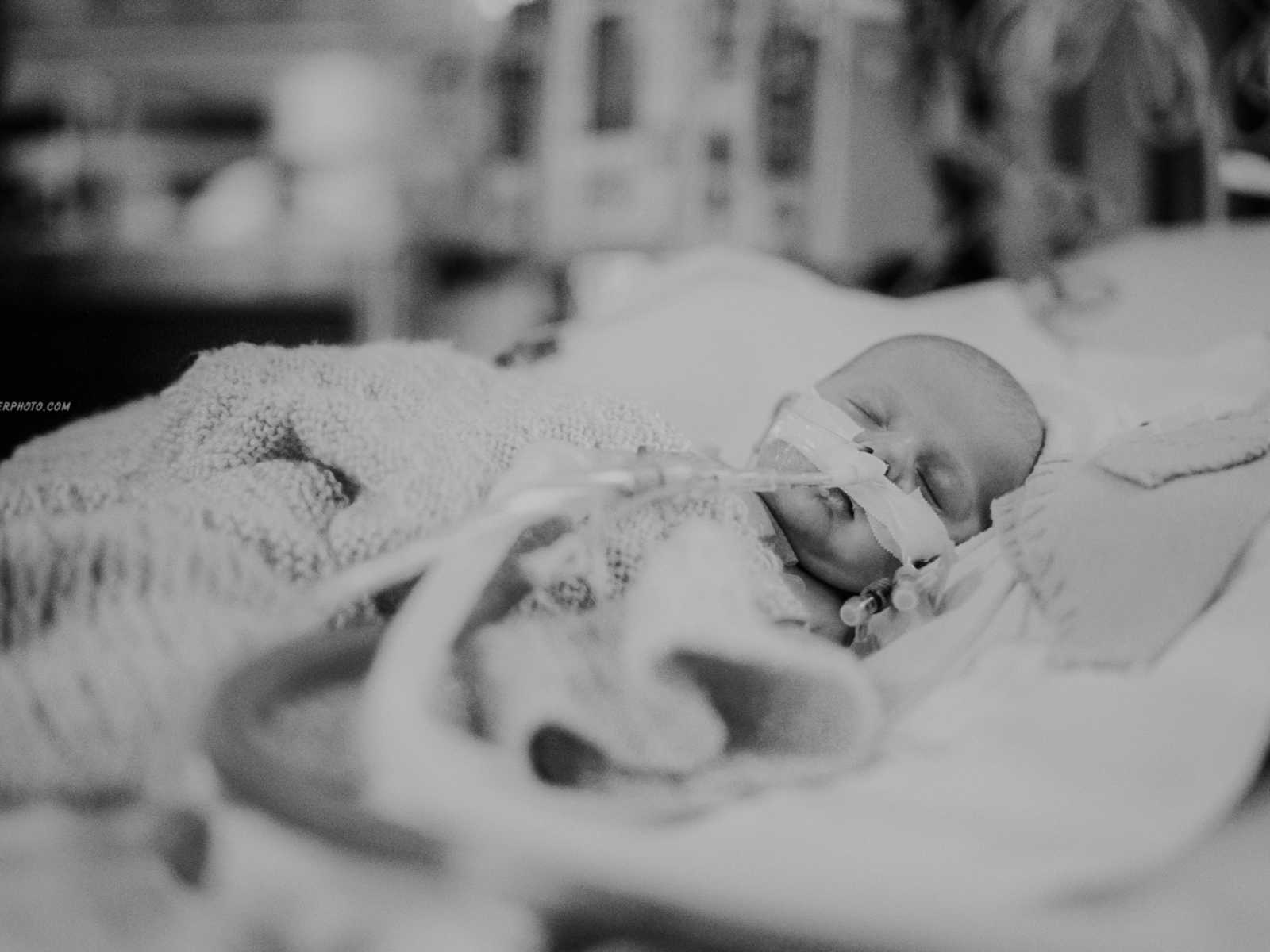 Newborn baby sleeping under blankets with tube up his nose