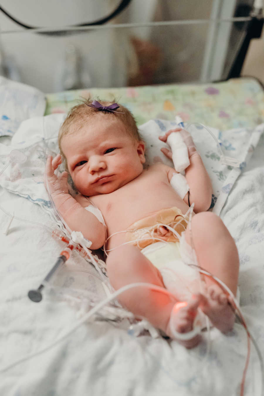 Newborn who will soon after pass away lying in hospital with wires attached to her