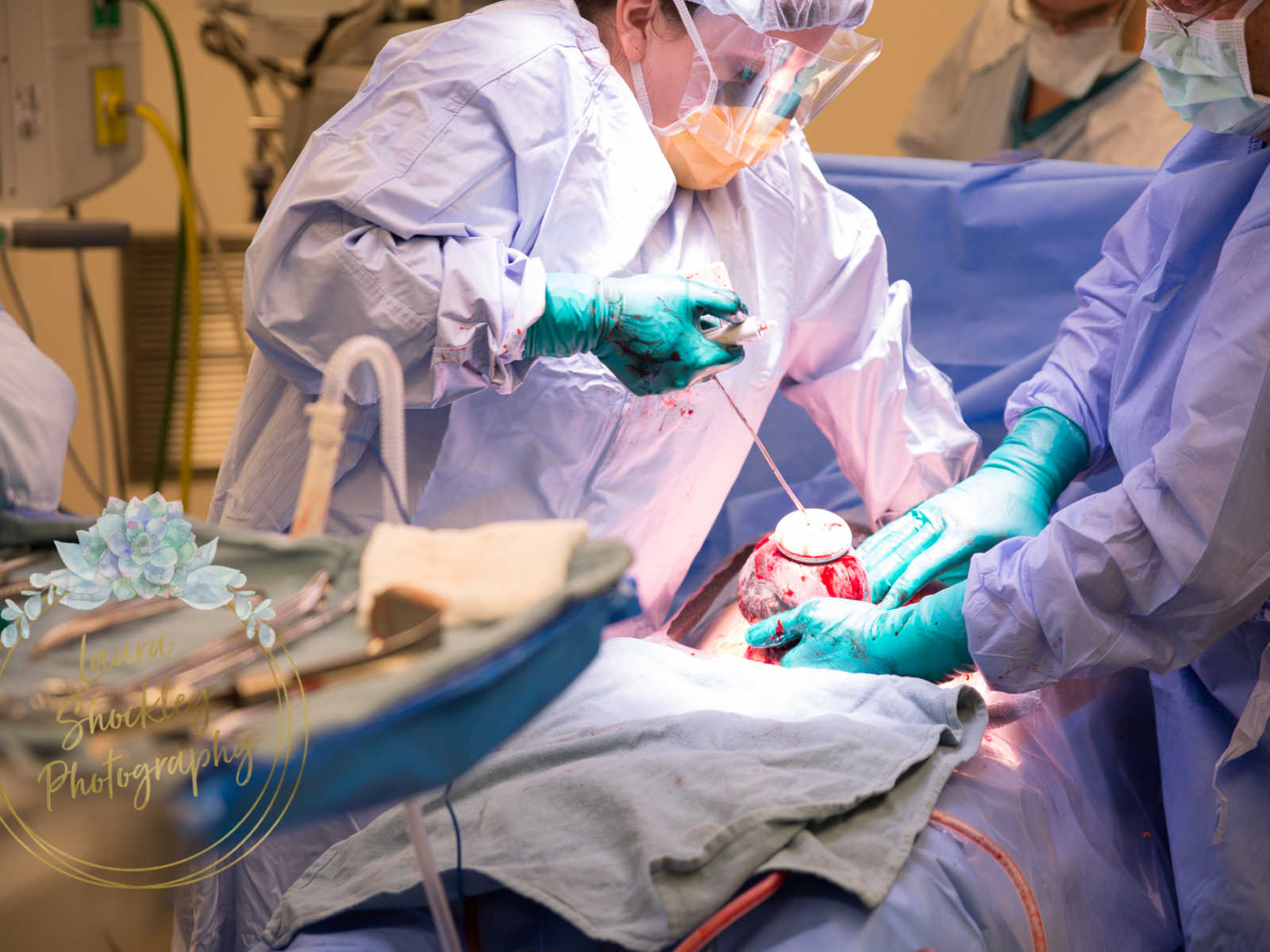 Doctor performing a c-section while another doctor pulls bloody baby's head out