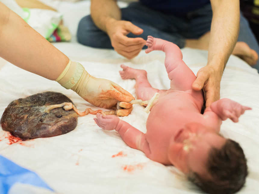 Newborn lying on her back while nurse holds umbilical chord that is still attached to her and placenta