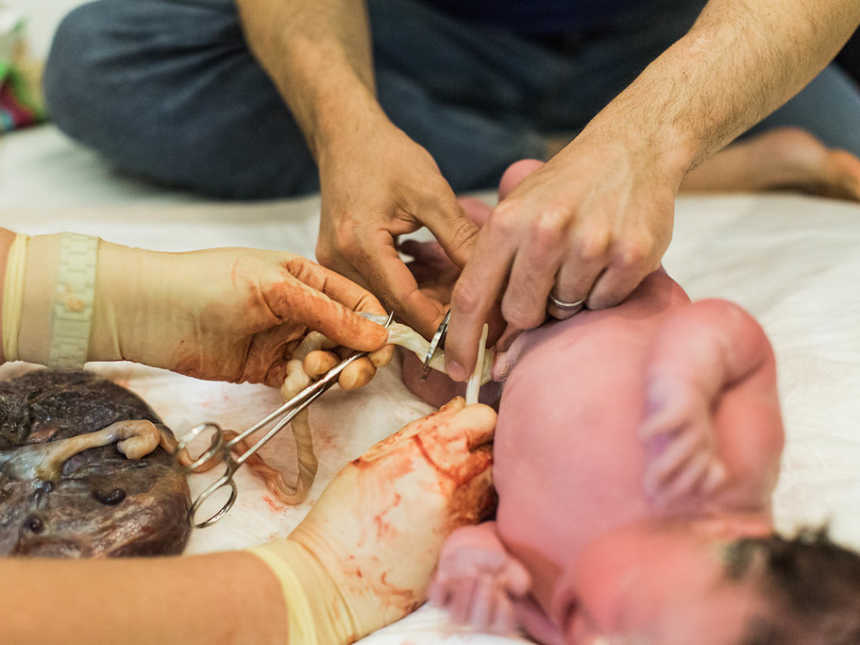 Father cuts newborn's umbilical chord while nurse holds it