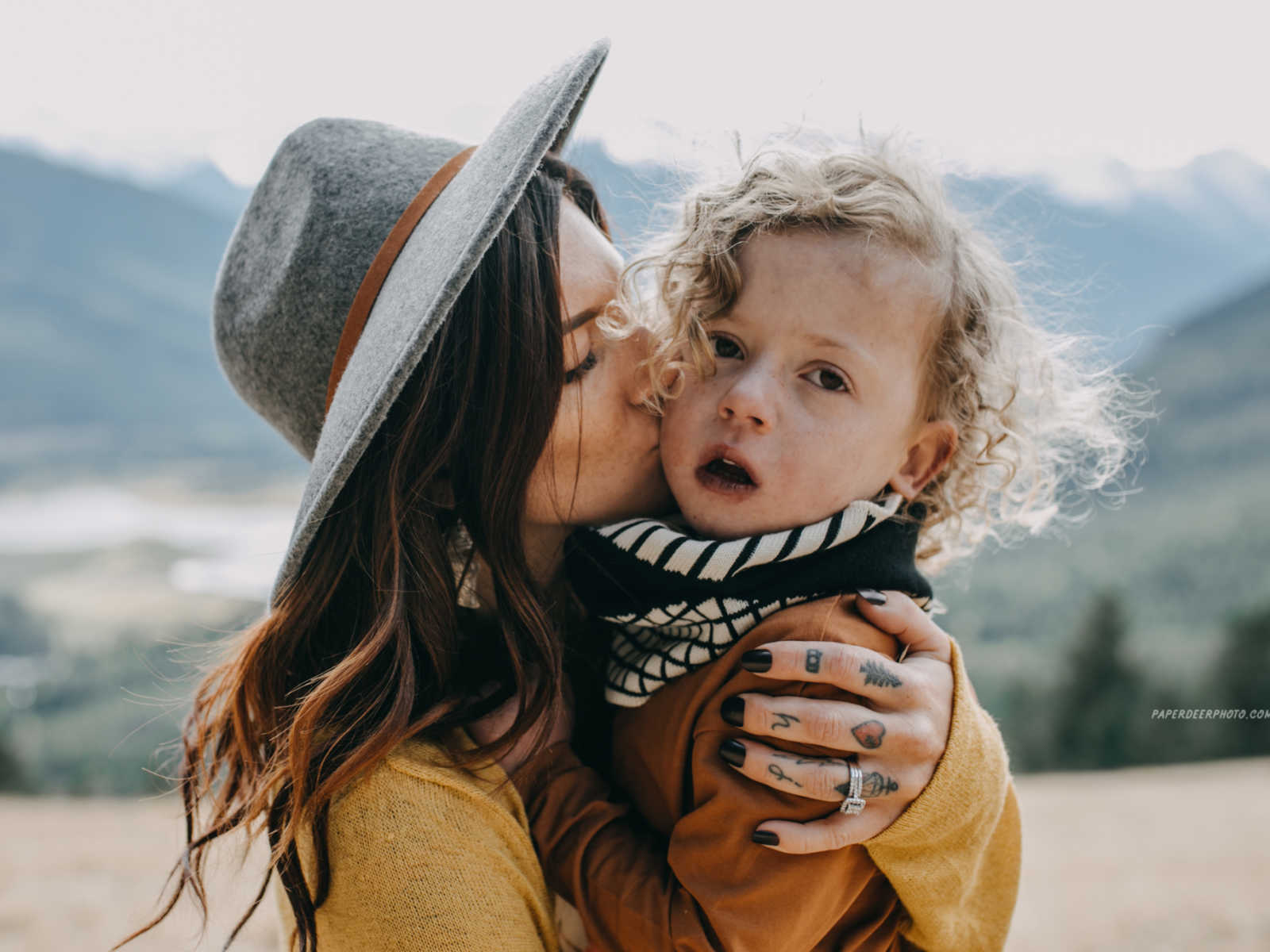 Mother kisses cheek of four year old son who has already has two heart surgeries