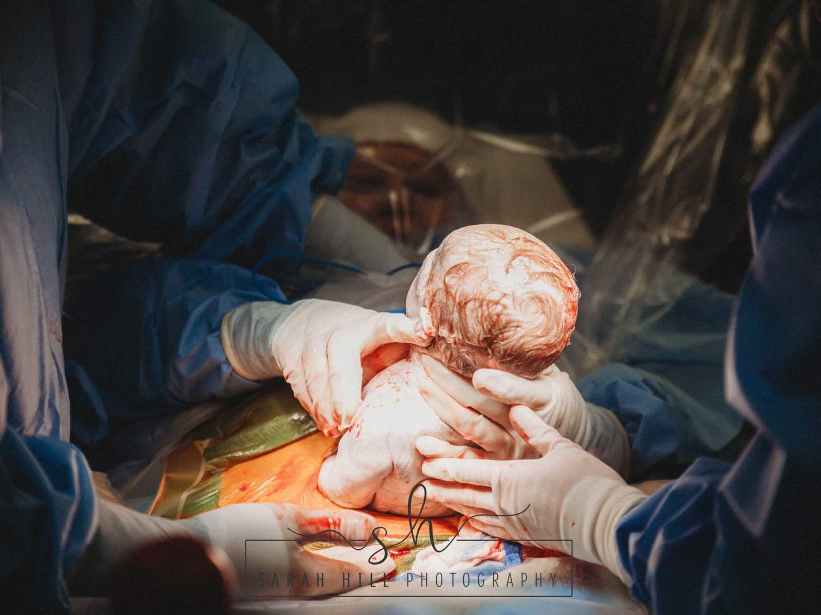 OBGYN performs c-section and she and mother who is also a midwife pull baby out together