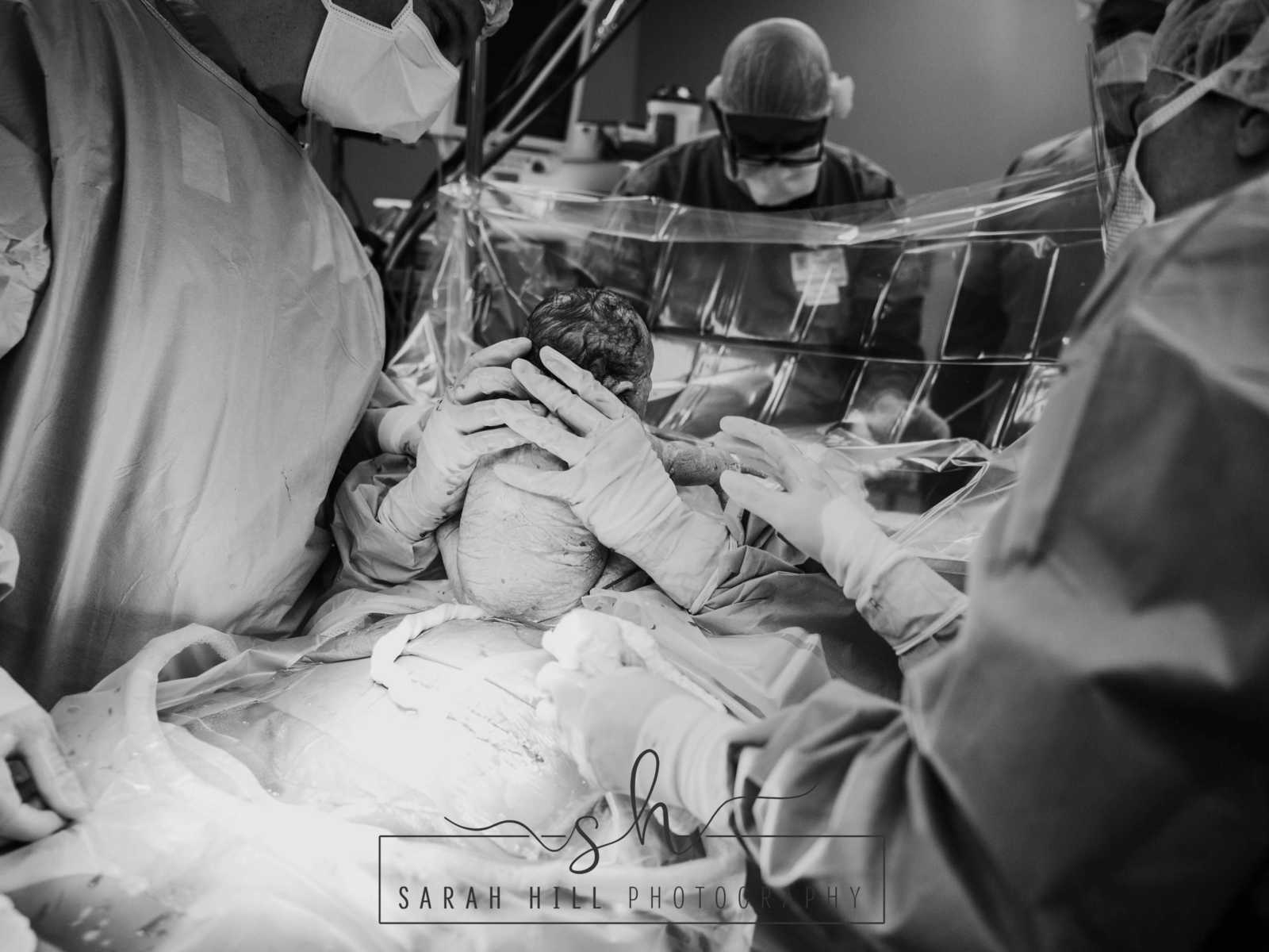 Woman who is also a midwife sits baby on her chest and looks at it through surgical shield