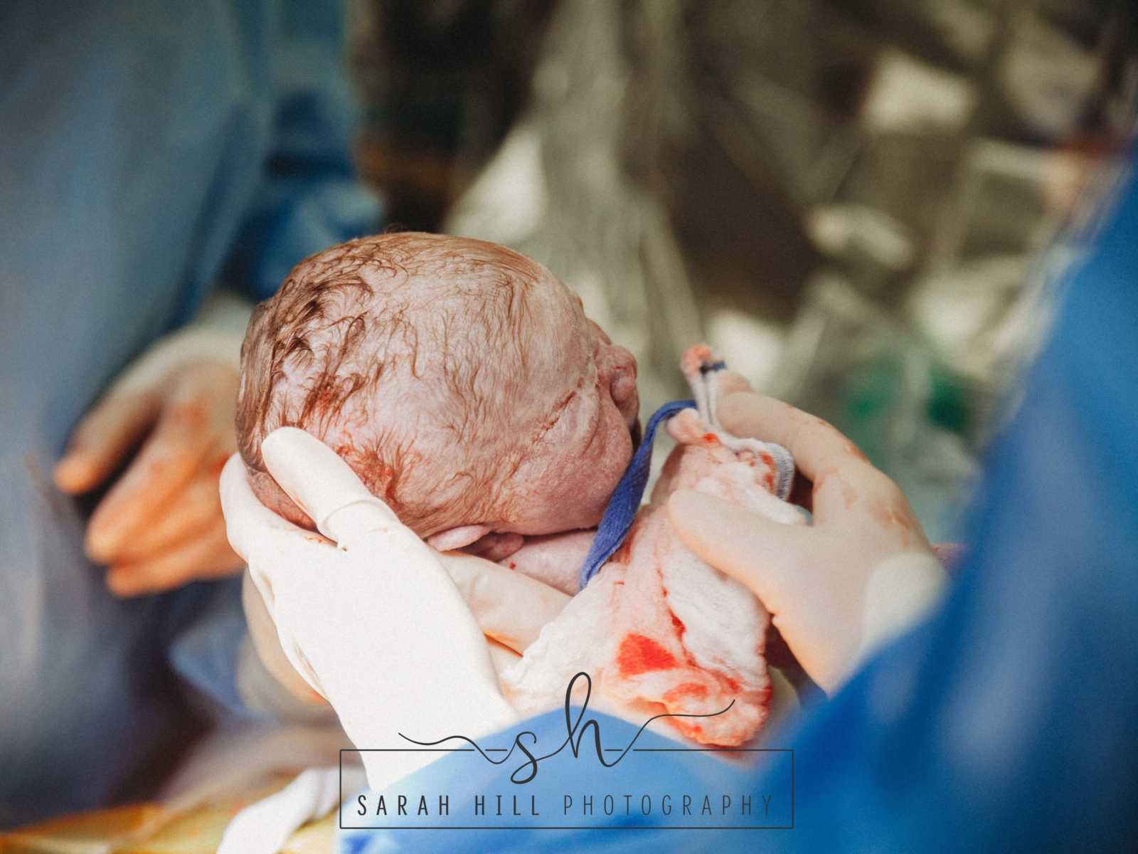 Nurse wiping down bloody c-section baby with a towel