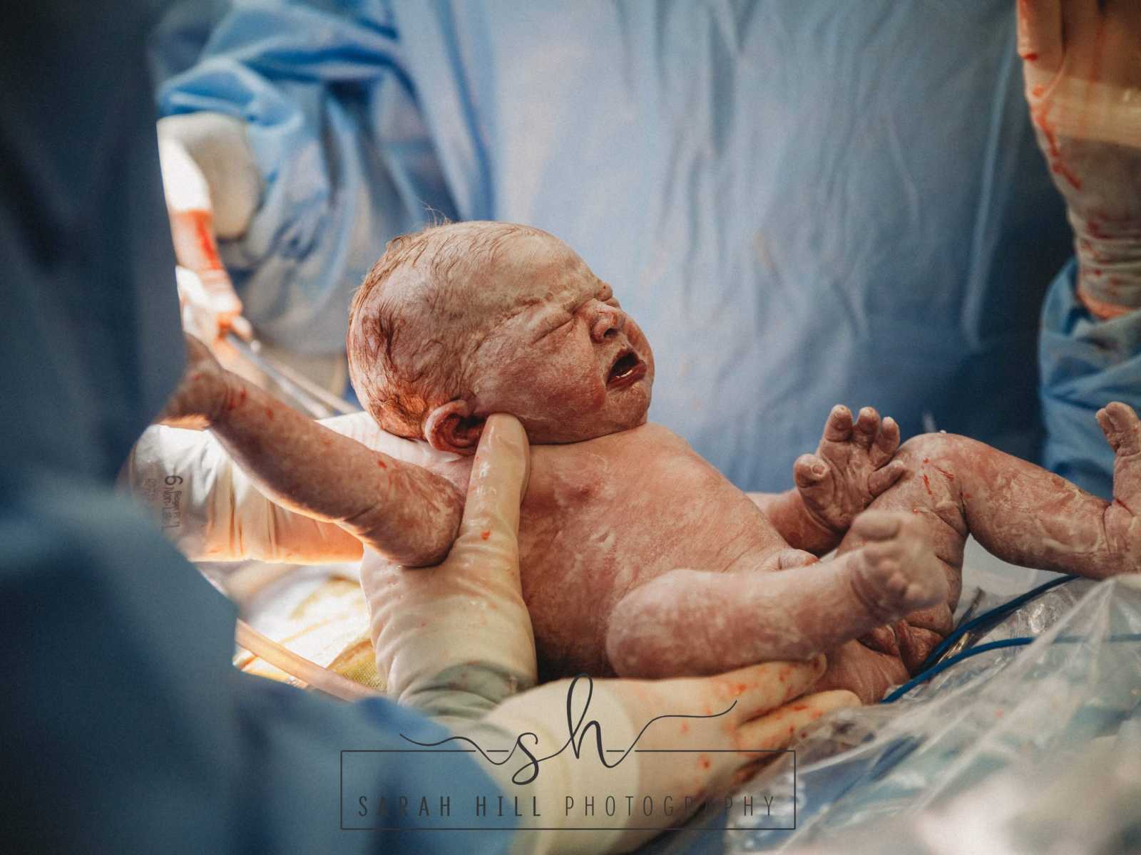 Newborn c-section baby crying