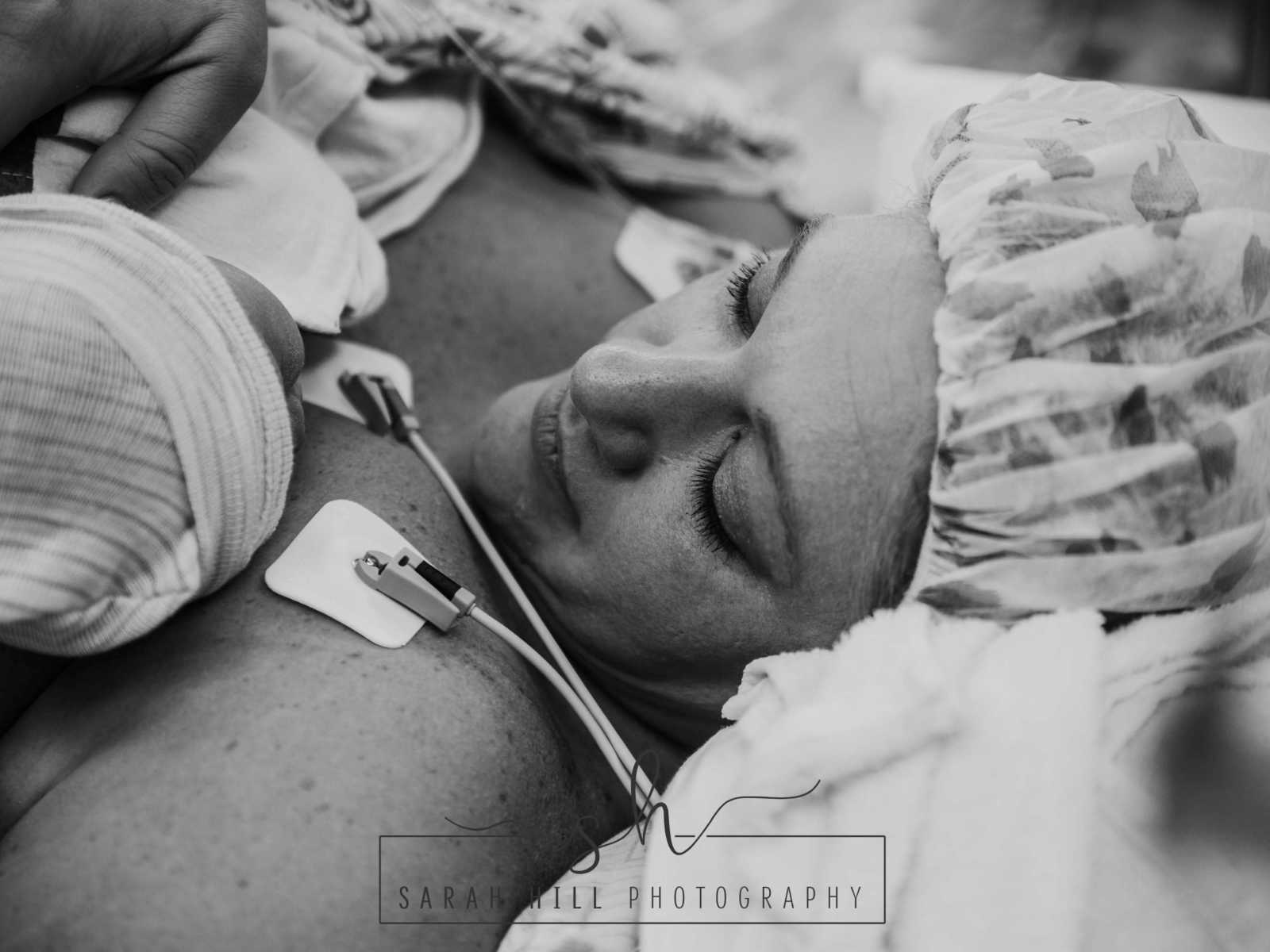 Woman who is also a midwife helped pull her c-section baby out lays with newborn on her bare chest